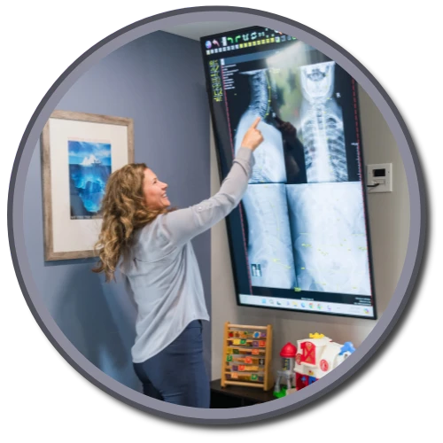 Gonstead X-rays